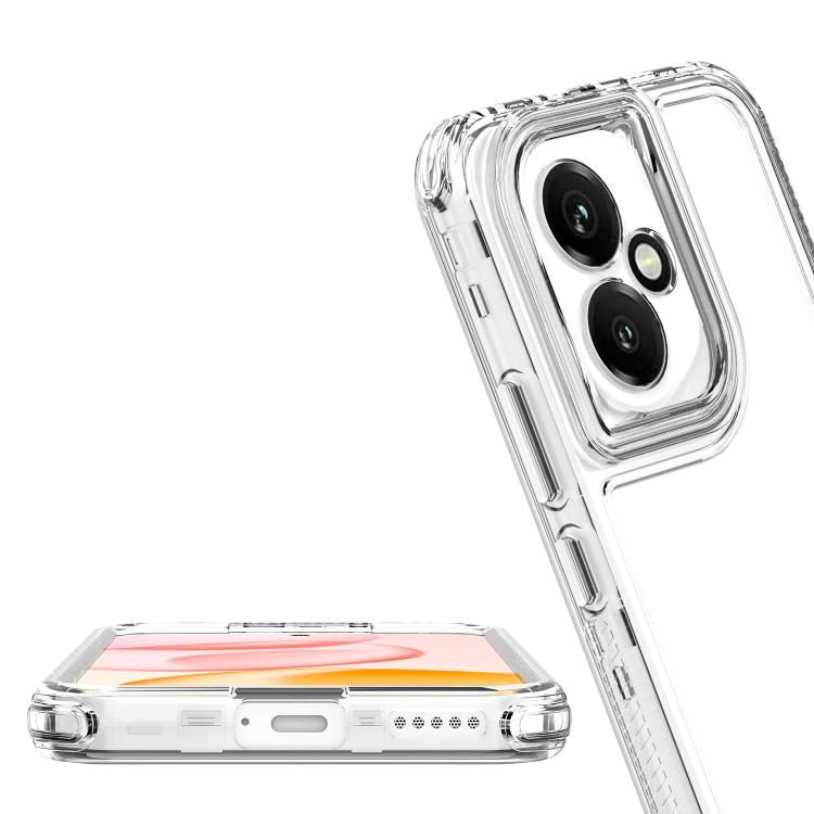 For Honor 400 Global 156.5mm Acrylic Transparent Phone Case
