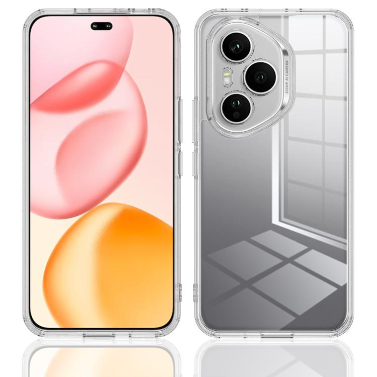 For Honor 400 Pro Global 160.8mm Scratchproof Acrylic TPU Phone Case - Transparent