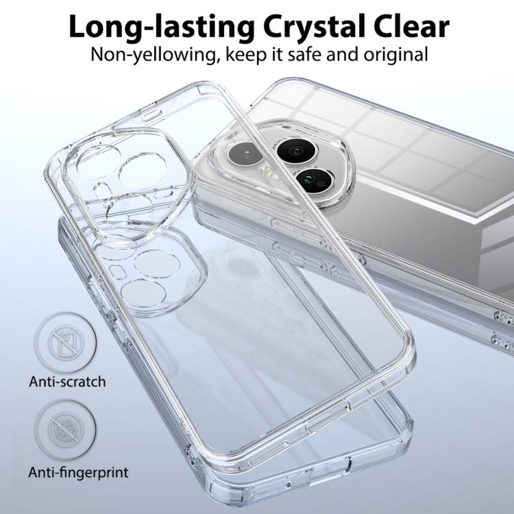 For Honor 400 Pro Global 160.8mm Scratchproof Acrylic TPU Phone Case - Transparent