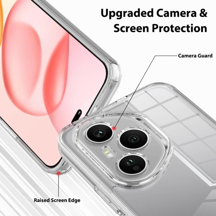 For Honor 400 Pro Global 160.8mm Scratchproof Acrylic TPU Phone Case - Transparent
