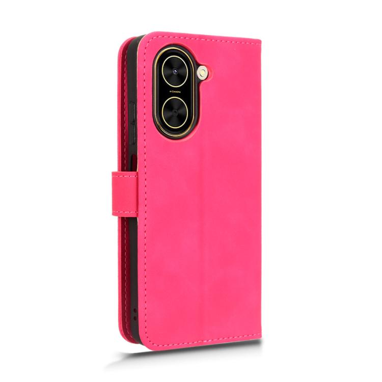 For Redmi A5 4G 173.3mm Skin Feel Magnetic Flip Leather Phone Case