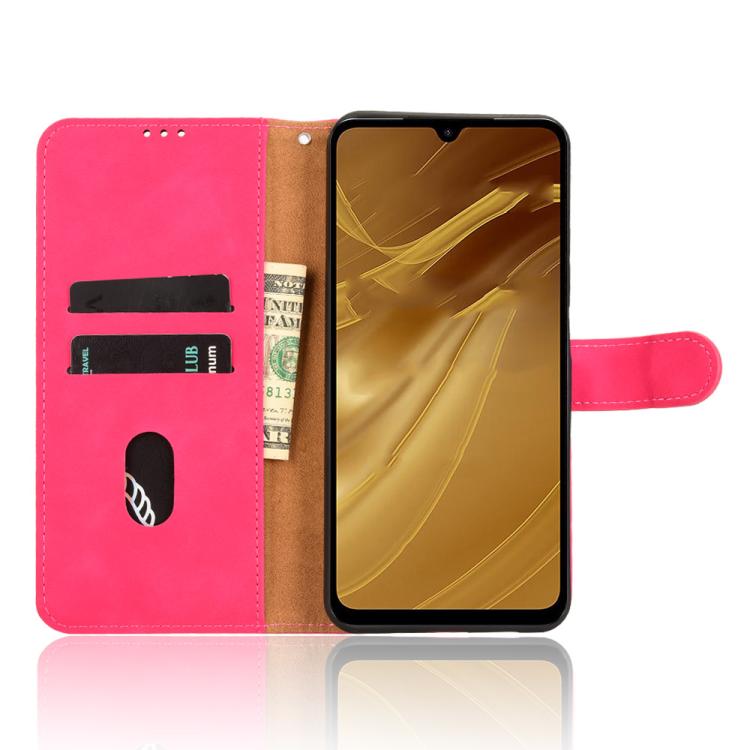 For Redmi A5 4G 173.3mm Skin Feel Magnetic Flip Leather Phone Case