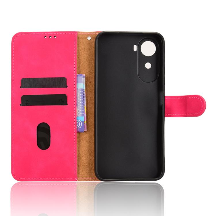 For Redmi A7 Pro 171mm / Poco C85x 5G Skin Feel Magnetic Flip Leather Phone Case