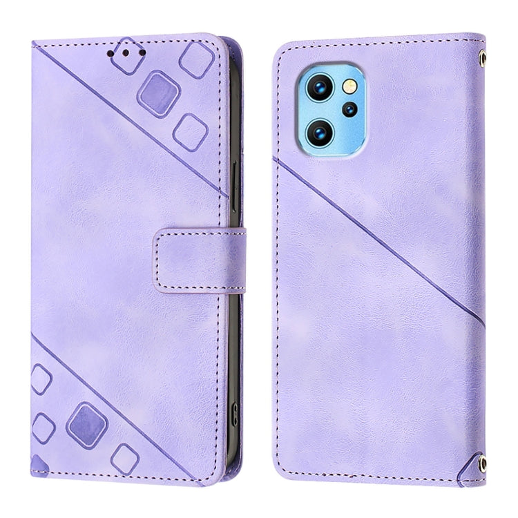 For UMIDIGI Power 7 Max Skin-feel Embossed Leather Phone Case