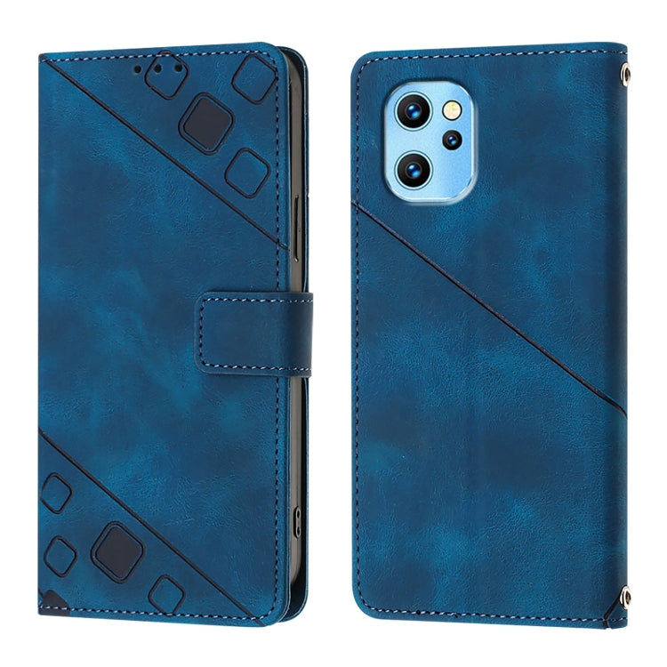 For UMIDIGI Power 7 Max Skin-feel Embossed Leather Phone Case