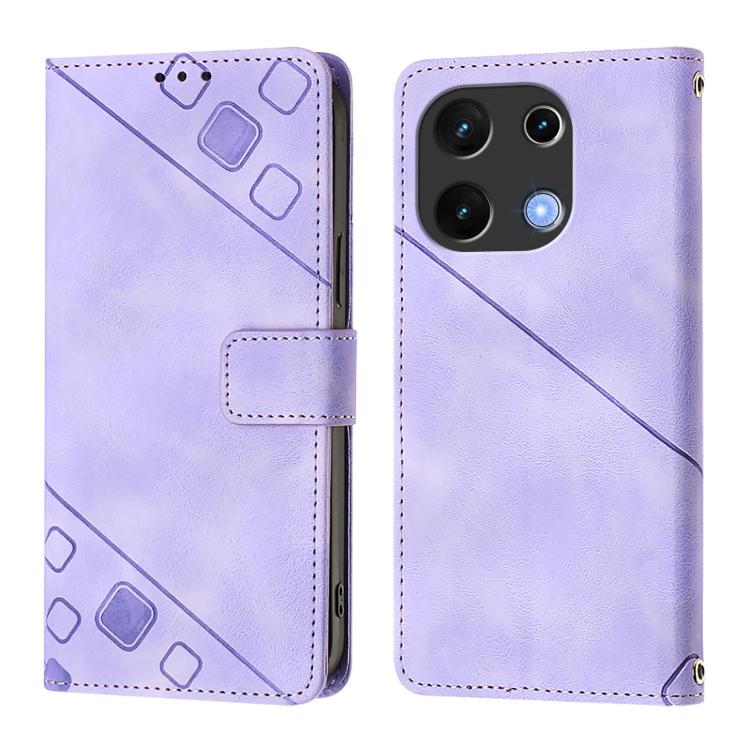 For UMIDIGI Note 100 Skin-feel Embossed Leather Phone Case