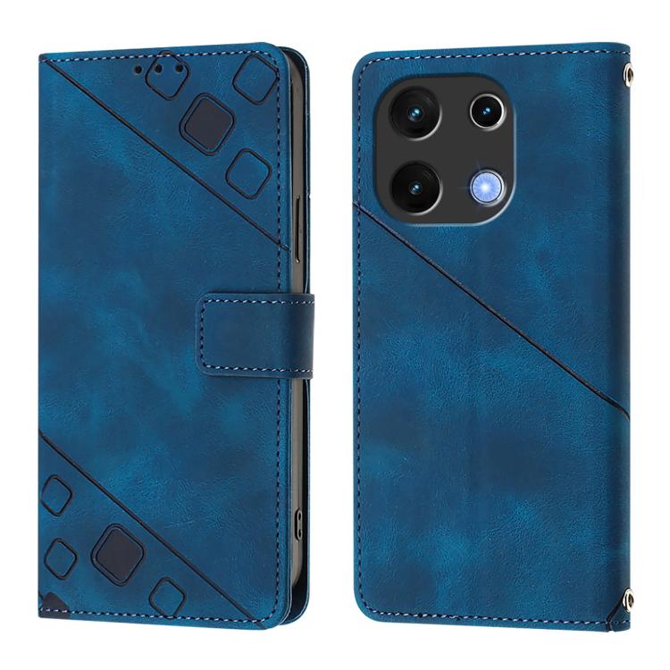 For UMIDIGI Note 100 Skin-feel Embossed Leather Phone Case