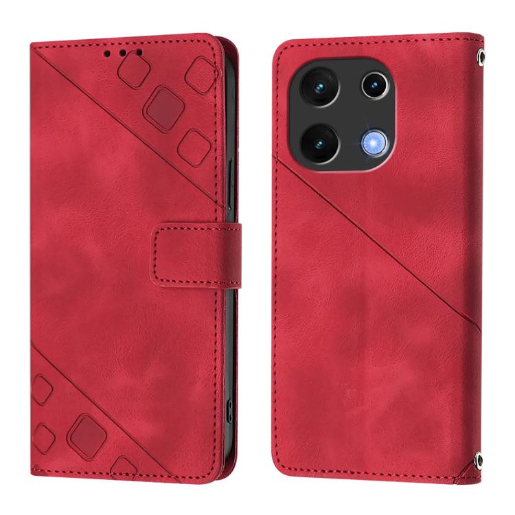 For UMIDIGI Note 100 Skin-feel Embossed Leather Phone Case