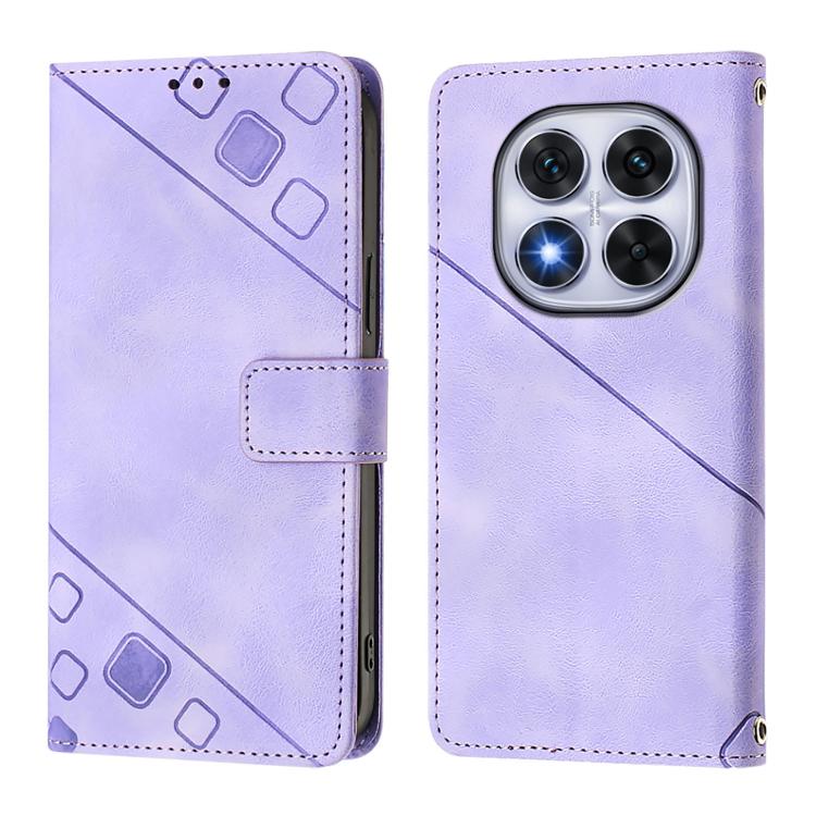For Xiaomi Poco X7 5G Skin-feel Embossed Leather Phone Case