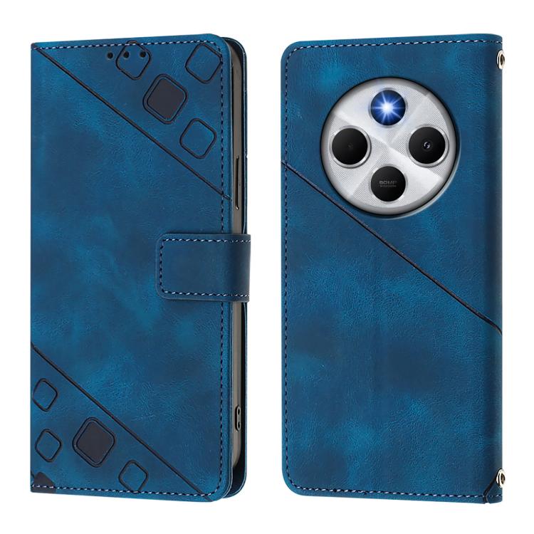 For Xiaomi Poco M7 5G / C75 4G Skin-feel Embossed Leather Phone Case