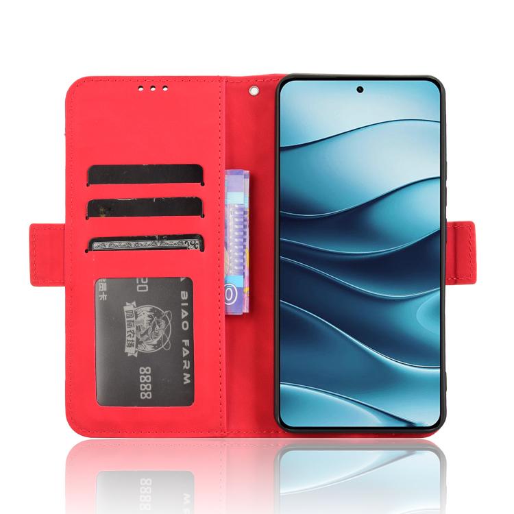 For Redmi Note 14 4G Global 163.25mm Skin Feel Calf Texture Card Slots Leather Phone Case