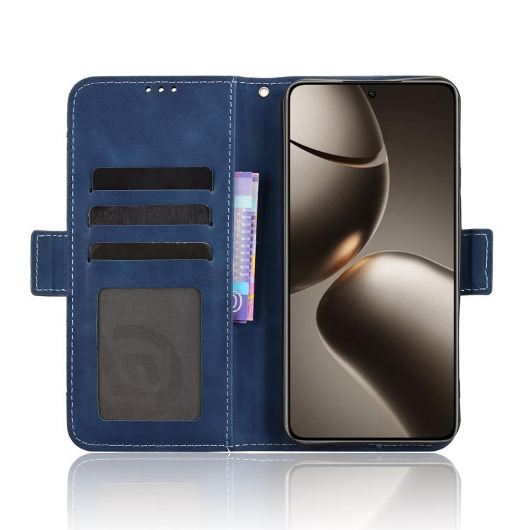 For Xiaomi 15T Pro 5G Skin Feel Calf Texture Card Slots Leather Phone Case