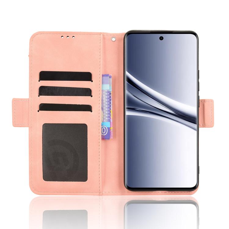 For Redmi Note 15 5G / 4G 164mm / Poco M8 5G Skin Feel Calf Texture Card Slots Leather Phone Case