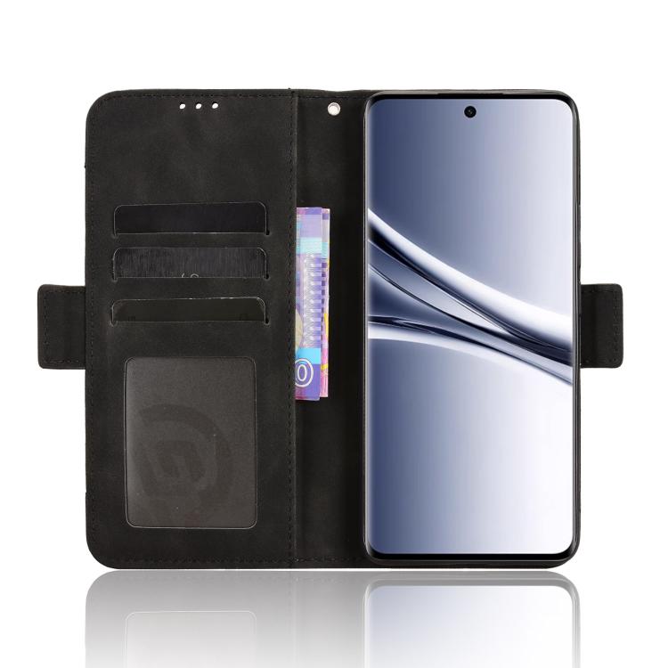 For Redmi Note 15 5G / 4G 164mm / Poco M8 5G Skin Feel Calf Texture Card Slots Leather Phone Case