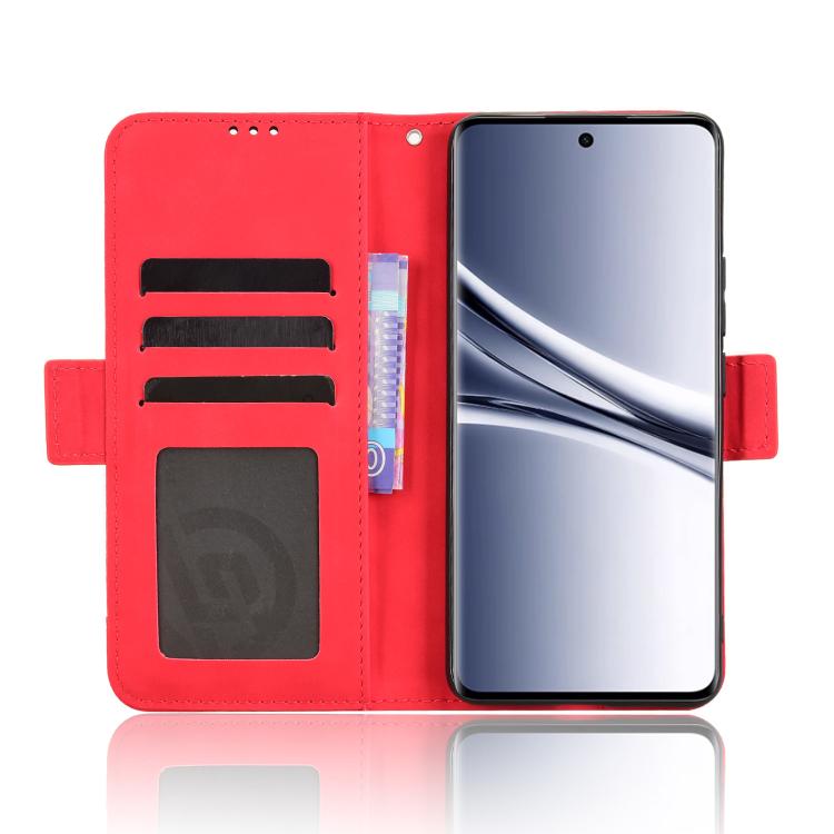 For Redmi Note 15 5G / 4G 164mm / Poco M8 5G Skin Feel Calf Texture Card Slots Leather Phone Case