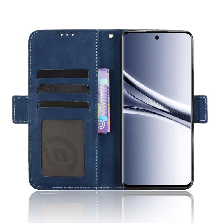 For Redmi Note 15 5G / 4G 164mm / Poco M8 5G Skin Feel Calf Texture Card Slots Leather Phone Case