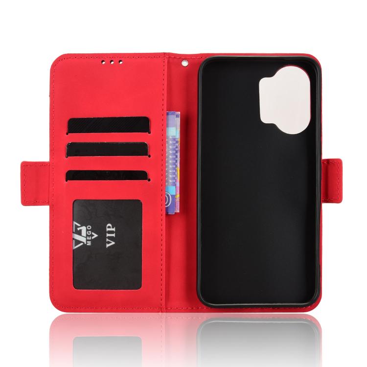 For Redmi Turbo 5 Max 5G / Poco X8 Pro Max Skin Feel Calf Texture Card Slots Leather Phone Case