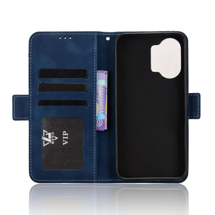 For Redmi Turbo 5 Max 5G / Poco X8 Pro Max Skin Feel Calf Texture Card Slots Leather Phone Case