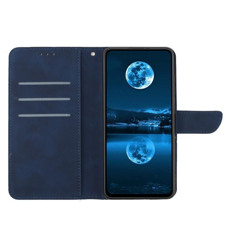 For Xiaomi 15T Pro Stitching Embossed Leather Phone Case