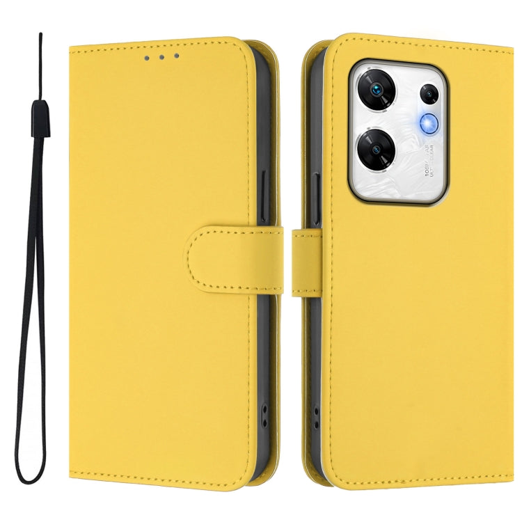 For Infinix Zero 30 4G Skin Feel Solid Color Leather Phone Case with Lanyard