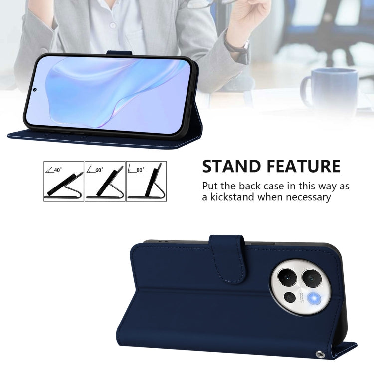 For vivo V40 Lite 5G / V30E 5G Global Skin Feel Solid Color Leather Phone Case with Lanyard