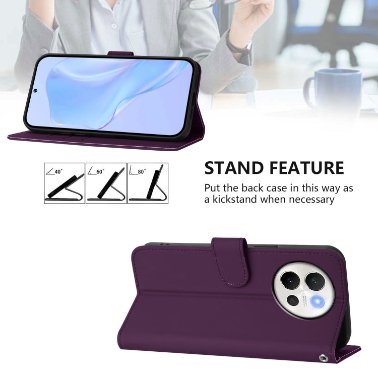 For vivo V40 Lite 5G / V30E 5G Global Skin Feel Solid Color Leather Phone Case with Lanyard