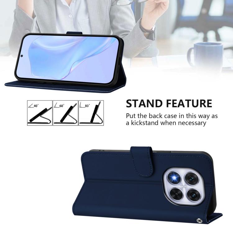 For Xiaomi Poco X7 5G Skin Feel Solid Color Leather Phone Case with Lanyard