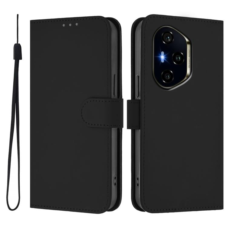 For Honor 400 Global 156.5mm Skin Feel Solid Color Leather Phone Case with Lanyard