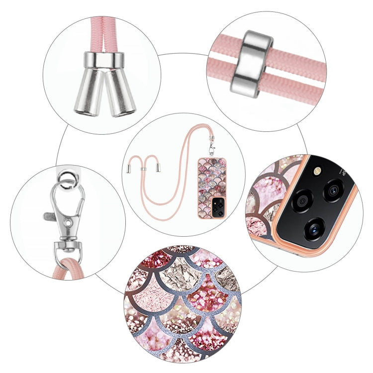 For Honor 200 Lite Global Electroplating Pattern IMD TPU Shockproof Case with Neck Lanyard