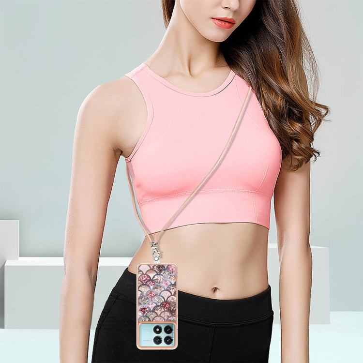 For Xiaomi Poco F6 Pro 5G Electroplating Pattern IMD TPU Shockproof Case with Neck Lanyard