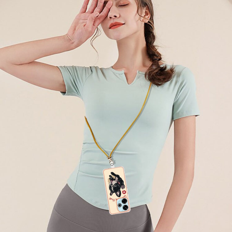 For Redmi 13 4G Electroplating Dual-side IMD Phone Case with Lanyard