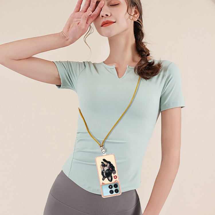 For Xiaomi Poco F6 Pro 5G Electroplating Dual-side IMD Phone Case with Lanyard