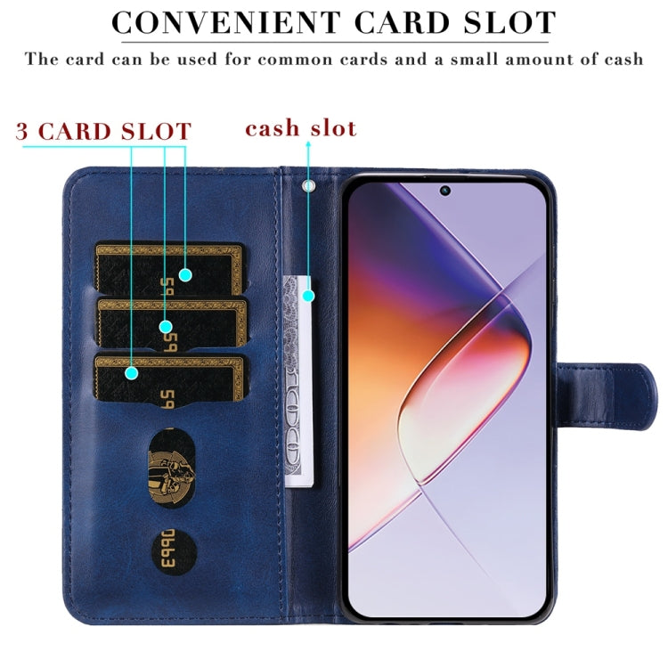 For Infinix Note 40 4G Fashion Calf Texture Zipper Leather Phone Case