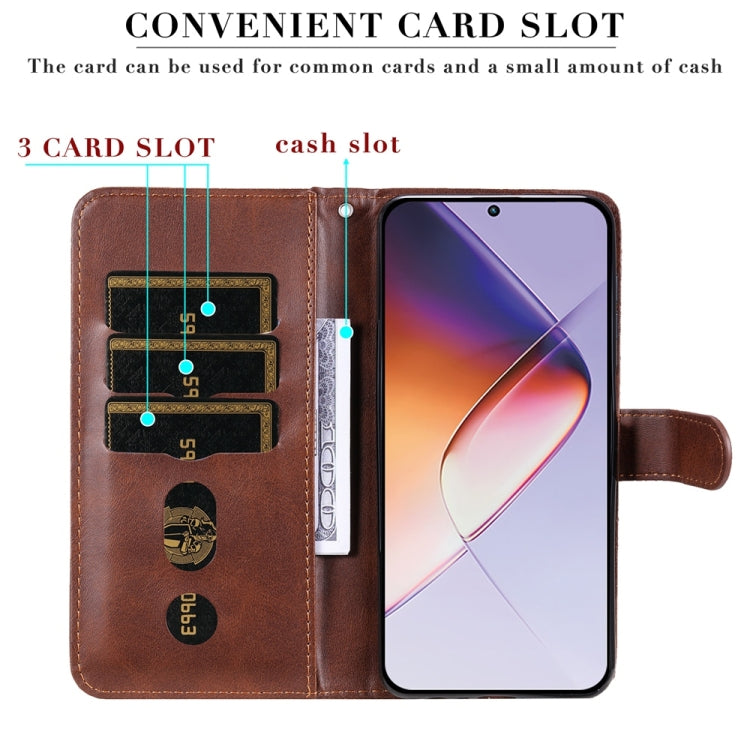 For Infinix Note 40 4G Fashion Calf Texture Zipper Leather Phone Case
