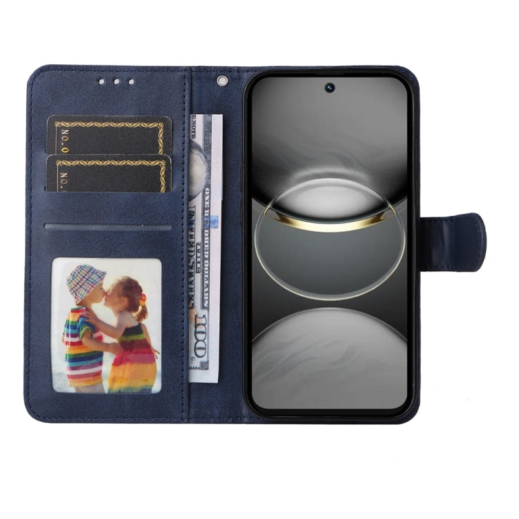 For Tecno Spark 30 Pro 4G Classic Calf Texture Flip Leather Phone Case