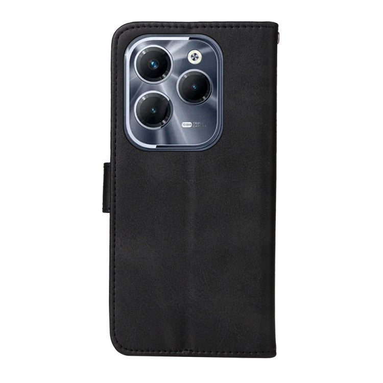 For Infinix Hot 40 / Hot 40 Pro Classic Calf Texture Flip Leather Phone Case