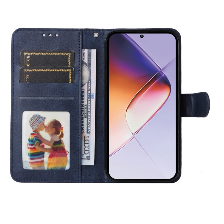 For Infinix Note 40 4G Classic Calf Texture Flip Leather Phone Case