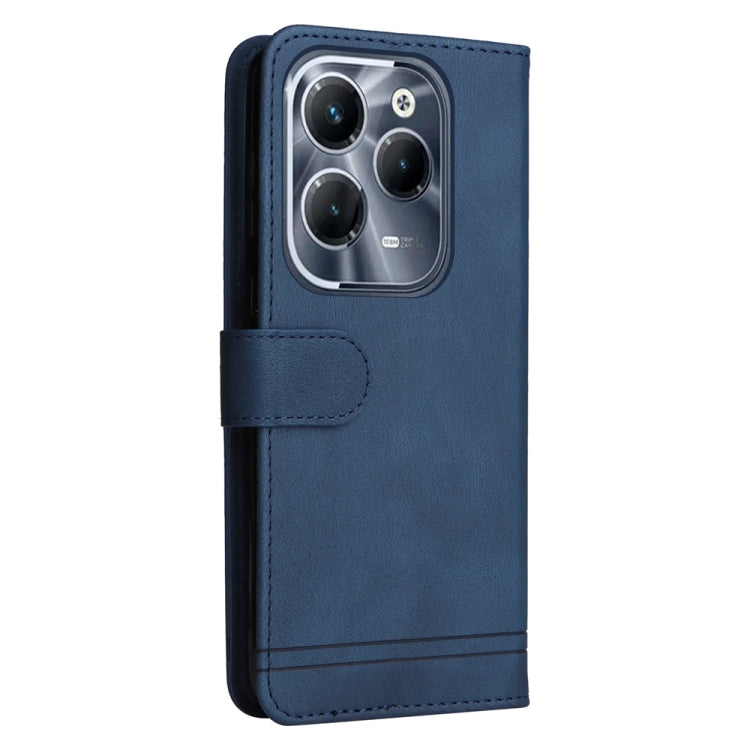 For Infinix Hot 40 / Hot 40 Pro Skin Feel Life Tree Metal Button Leather Phone Case