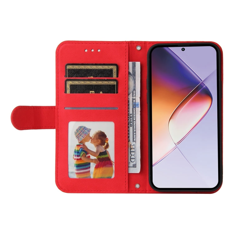 For Infinix Note 40 4G Skin Feel Life Tree Metal Button Leather Phone Case
