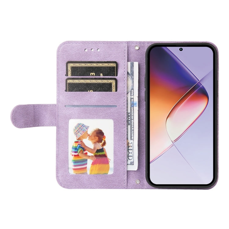 For Infinix Note 40 4G Skin Feel Life Tree Metal Button Leather Phone Case