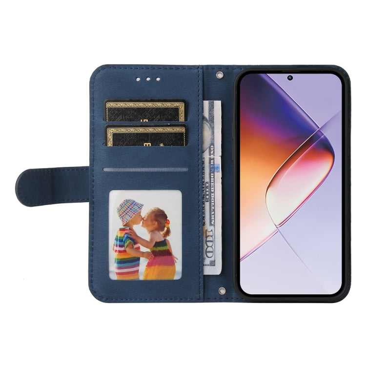 For Infinix Note 40 4G Skin Feel Life Tree Metal Button Leather Phone Case