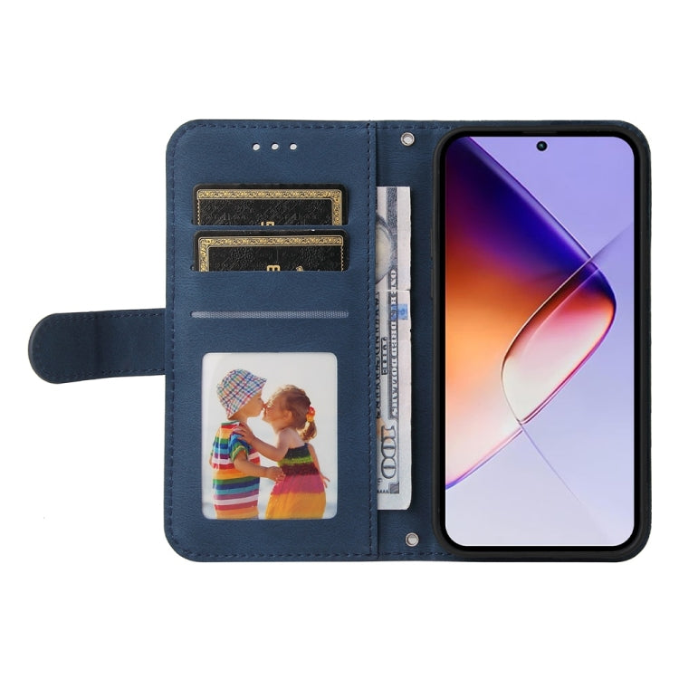 For Infinix Note 40 5G Skin Feel Life Tree Metal Button Leather Phone Case