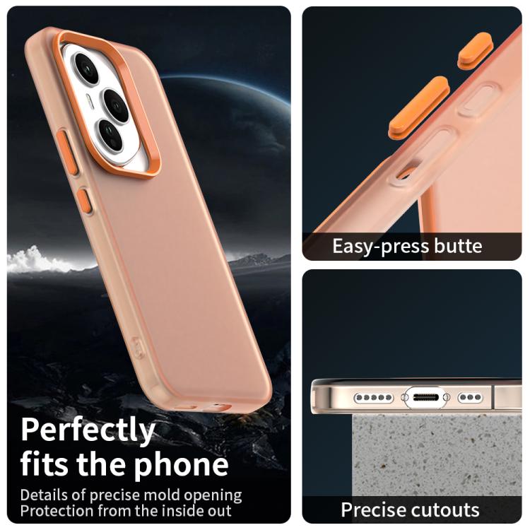 For Honor 400 Pro Global 160.8mm Candy PC Hybrid TPU Shockproof Phone Case