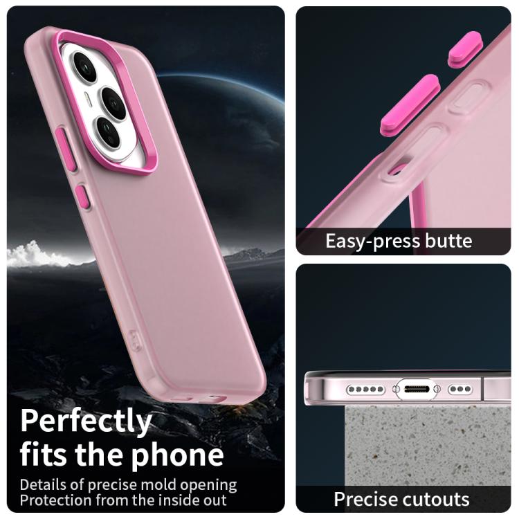 For Honor 400 Pro Global 160.8mm Candy PC Hybrid TPU Shockproof Phone Case