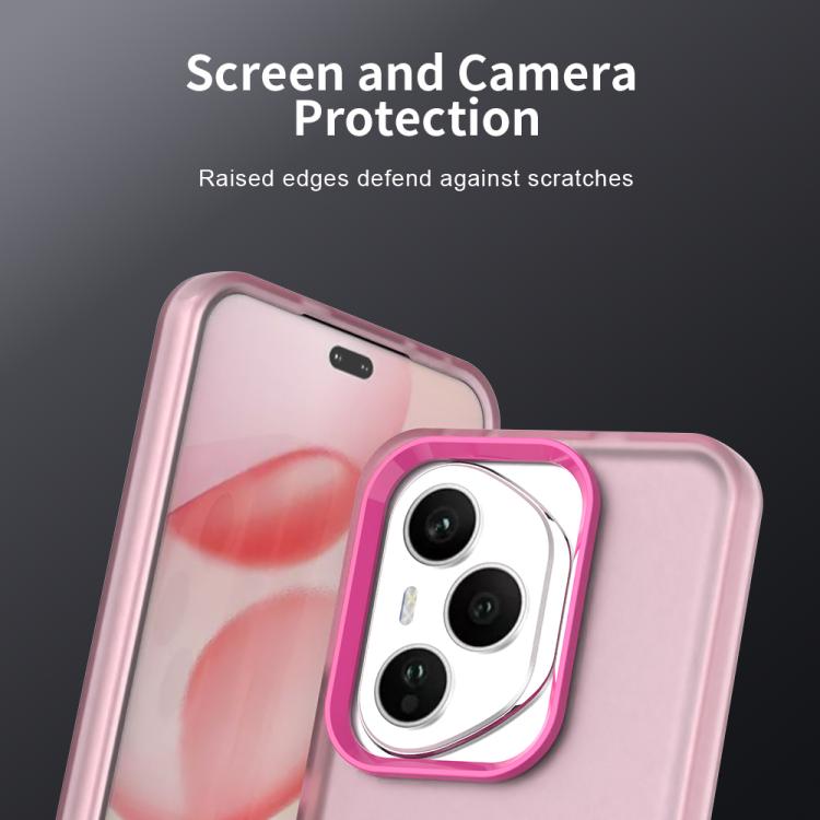 For Honor 400 Pro Global 160.8mm Candy PC Hybrid TPU Shockproof Phone Case