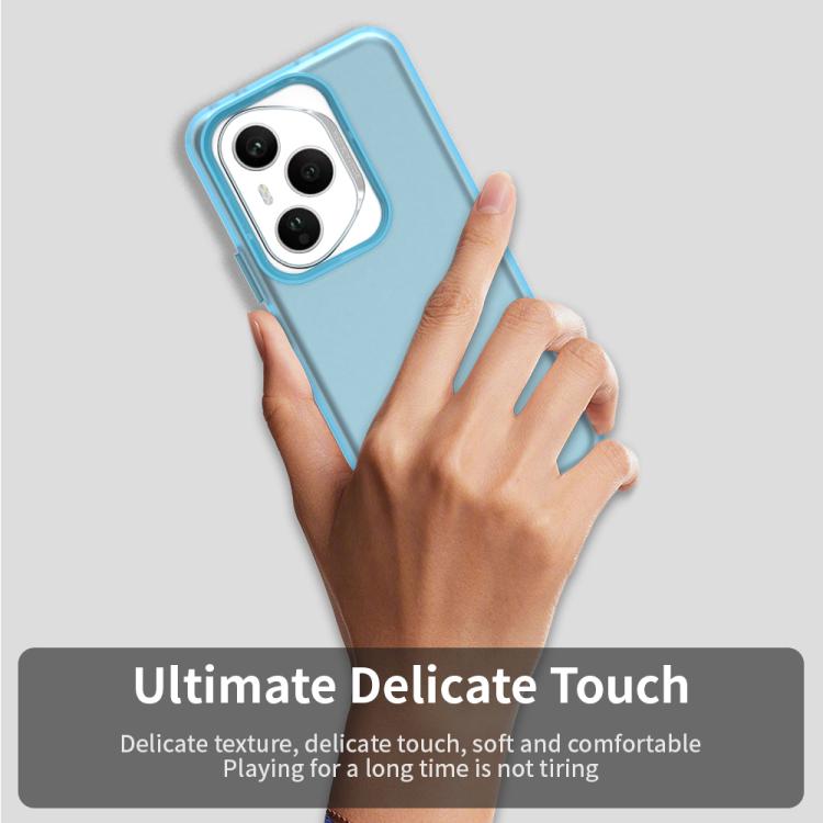For Honor 400 Pro Global 160.8mm Candy PC Hybrid TPU Shockproof Phone Case