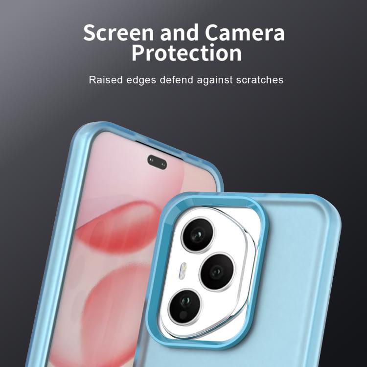 For Honor 400 Pro Global 160.8mm Candy PC Hybrid TPU Shockproof Phone Case