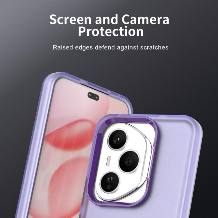 For Honor 400 Pro Global 160.8mm Candy PC Hybrid TPU Shockproof Phone Case