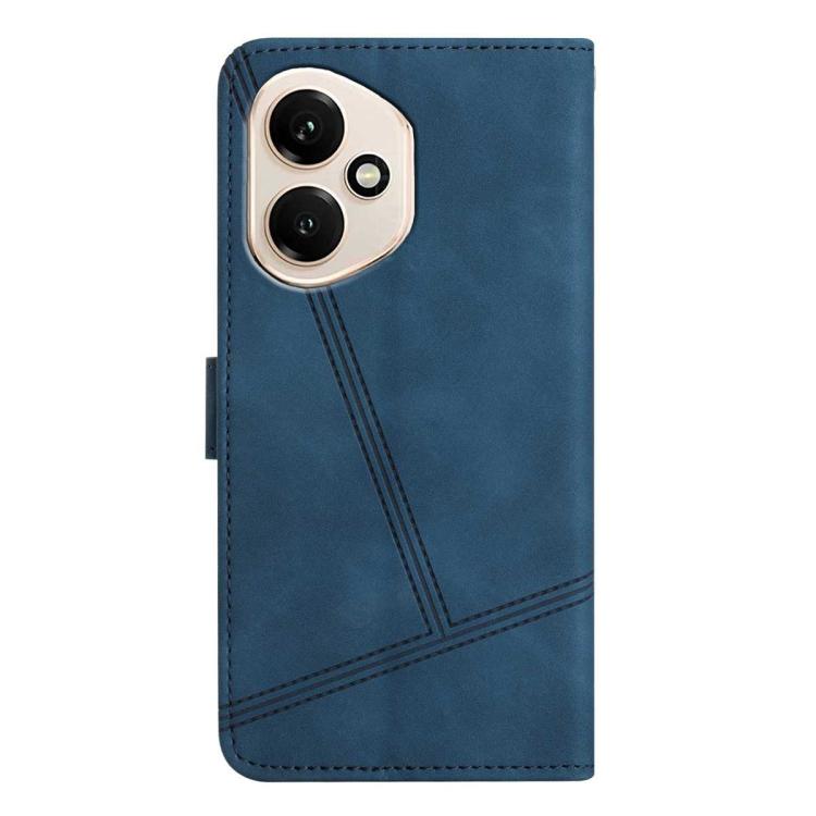 For Honor 400 Global 156.5mm Skin-feel Stitching Leather Phone Case