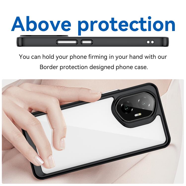For Honor 300 Colorful Series Acrylic Hybrid TPU Phone Case